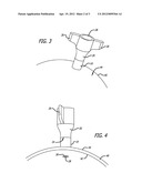 Bolt Stop System For Use In Accessing Intracranial Space diagram and image