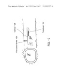 ULTRASOUND TRANSDUCER AND COOLING THEREOF diagram and image