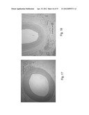 ULTRASOUND TRANSDUCER AND COOLING THEREOF diagram and image