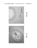 ULTRASOUND TRANSDUCER AND COOLING THEREOF diagram and image