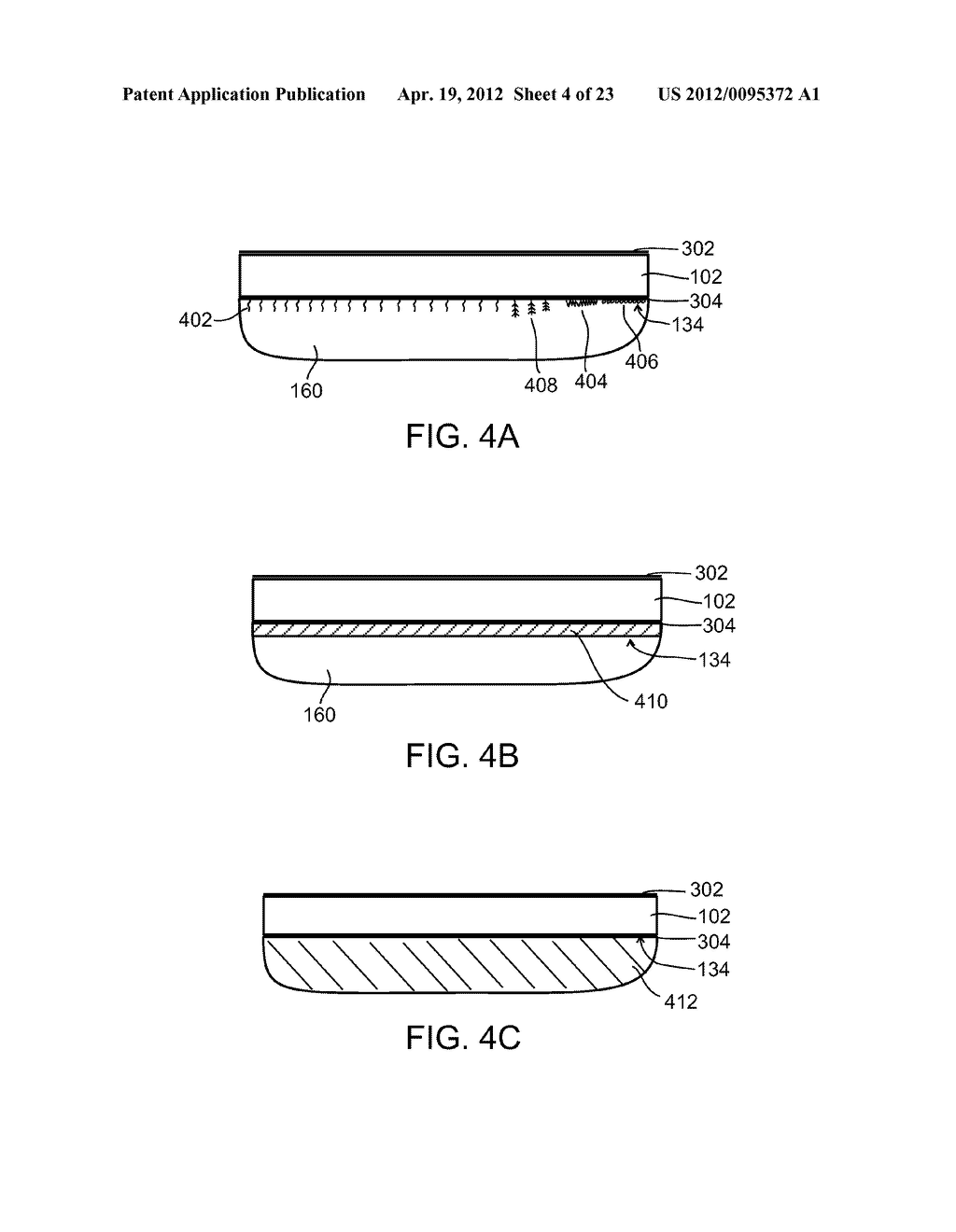 ULTRASOUND TRANSDUCER - diagram, schematic, and image 05