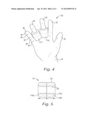 METHOD AND DEVICES FOR PREVENTING OR MINIMIZING RECURRENT ELBOW TENDINOSIS diagram and image