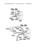 GAMMA ACCUMULATOR diagram and image