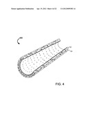 SYSTEMS AND METHODS FOR AN ADVANCED MEDICAL DEVICE diagram and image