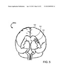 SYSTEMS AND METHODS FOR AN ADVANCED MEDICAL DEVICE diagram and image