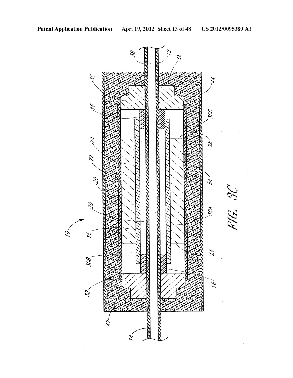 ULTRASOUND CATHETER FOR PROVIDING A THERAPEUTIC EFFECT TO A VESSEL OF A     BODY - diagram, schematic, and image 14