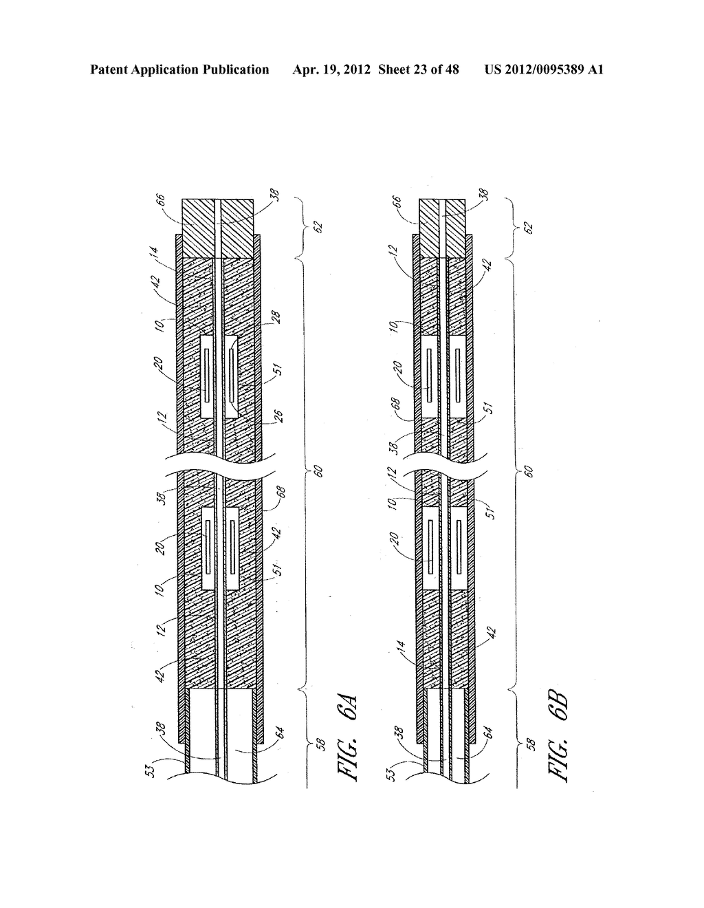 ULTRASOUND CATHETER FOR PROVIDING A THERAPEUTIC EFFECT TO A VESSEL OF A     BODY - diagram, schematic, and image 24