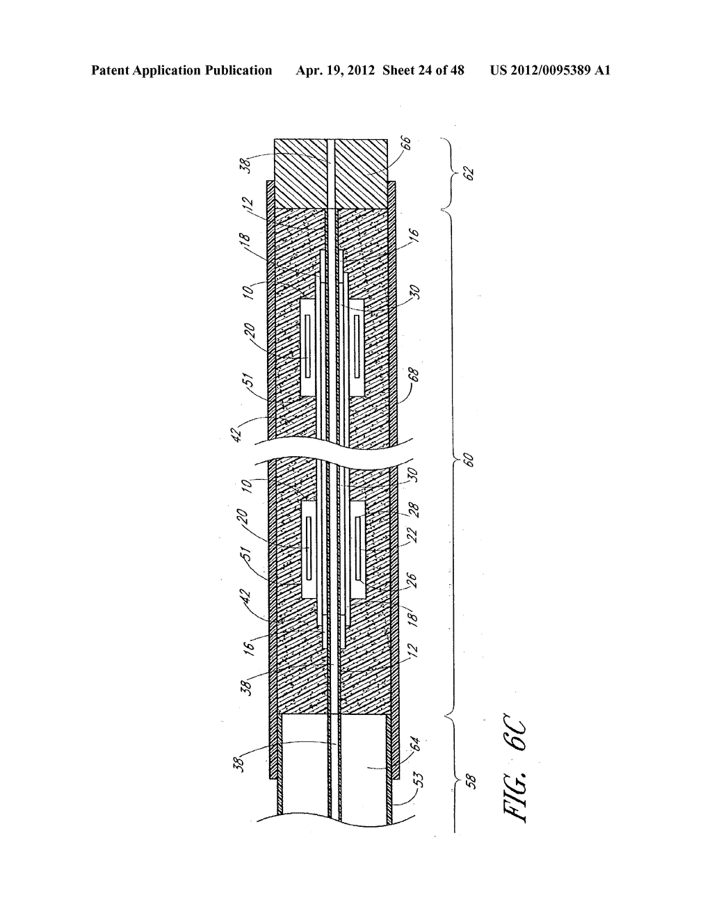 ULTRASOUND CATHETER FOR PROVIDING A THERAPEUTIC EFFECT TO A VESSEL OF A     BODY - diagram, schematic, and image 25
