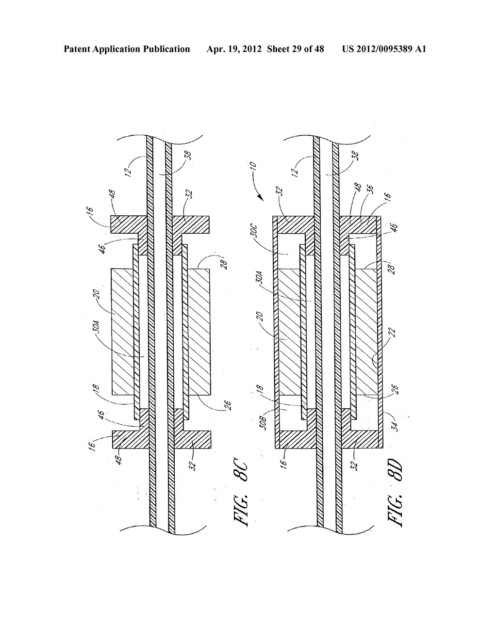 ULTRASOUND CATHETER FOR PROVIDING A THERAPEUTIC EFFECT TO A VESSEL OF A     BODY - diagram, schematic, and image 30