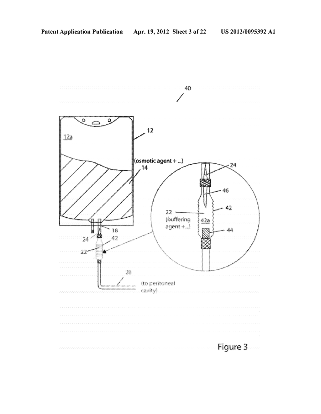 SYSTEMS AND METHODS FOR DELIVERY OF PERITONEAL DIALYSIS (PD) SOLUTIONS     WITH INTEGRATED INTER-CHAMBER DIFFUSER - diagram, schematic, and image 04