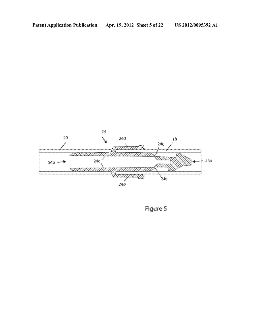 SYSTEMS AND METHODS FOR DELIVERY OF PERITONEAL DIALYSIS (PD) SOLUTIONS     WITH INTEGRATED INTER-CHAMBER DIFFUSER - diagram, schematic, and image 06