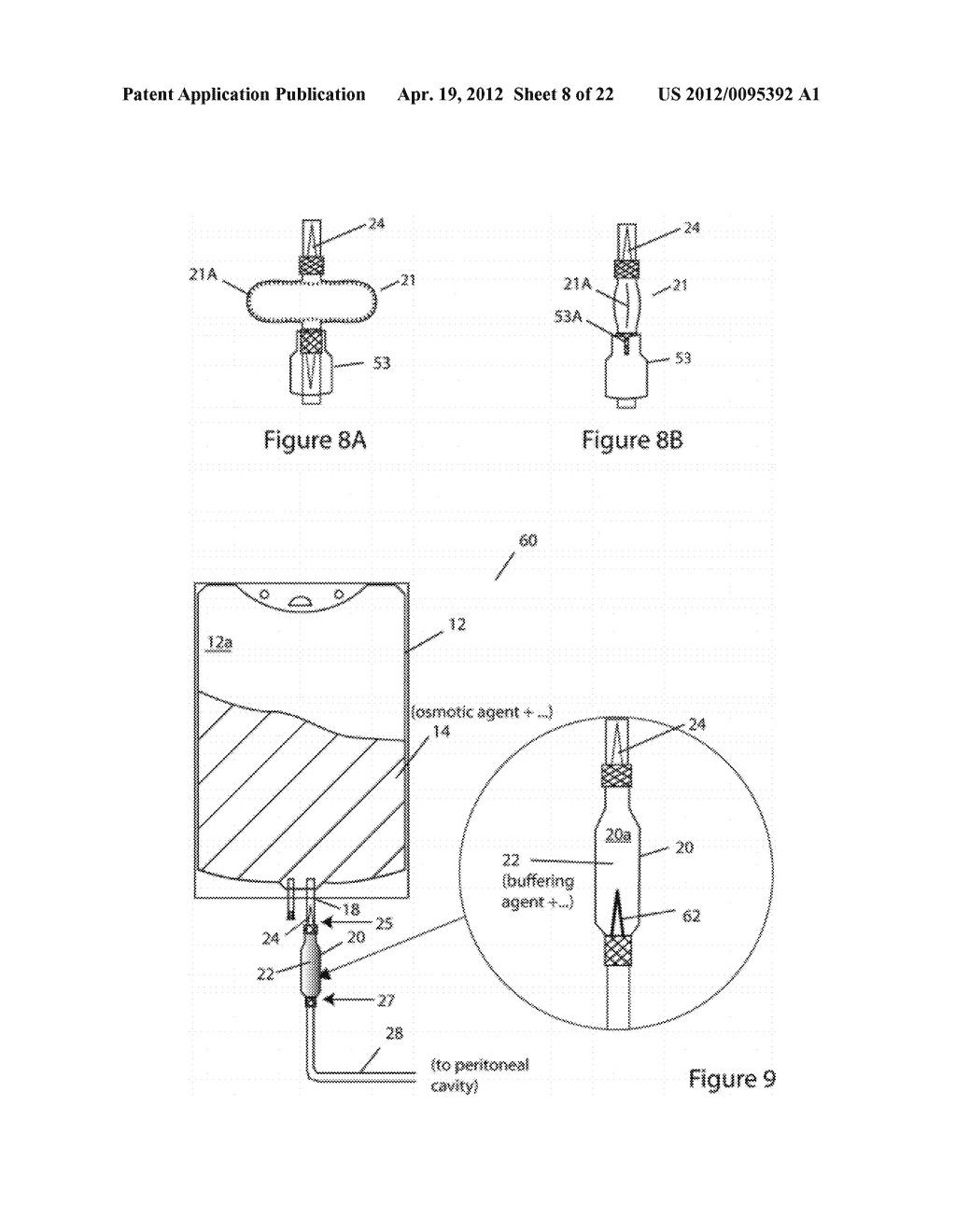 SYSTEMS AND METHODS FOR DELIVERY OF PERITONEAL DIALYSIS (PD) SOLUTIONS     WITH INTEGRATED INTER-CHAMBER DIFFUSER - diagram, schematic, and image 09