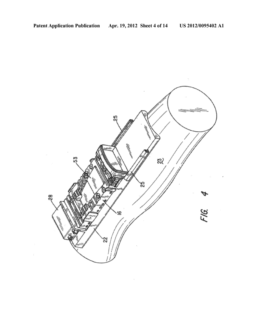 Chronic Access System for Extracorporeal Treatment of Blood Including a     Continuously Wearable Hemodialyzer - diagram, schematic, and image 05