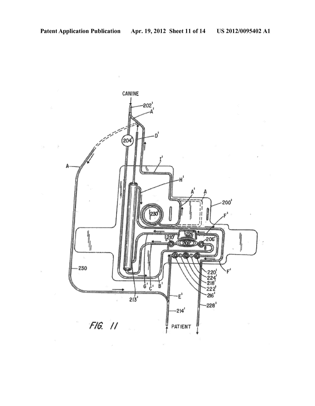 Chronic Access System for Extracorporeal Treatment of Blood Including a     Continuously Wearable Hemodialyzer - diagram, schematic, and image 12