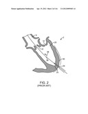 SYSTEM FOR PROVIDING SURGICAL ACCESS diagram and image