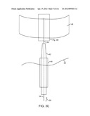 SYSTEM FOR PROVIDING SURGICAL ACCESS diagram and image