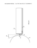 SYSTEM FOR PROVIDING SURGICAL ACCESS diagram and image