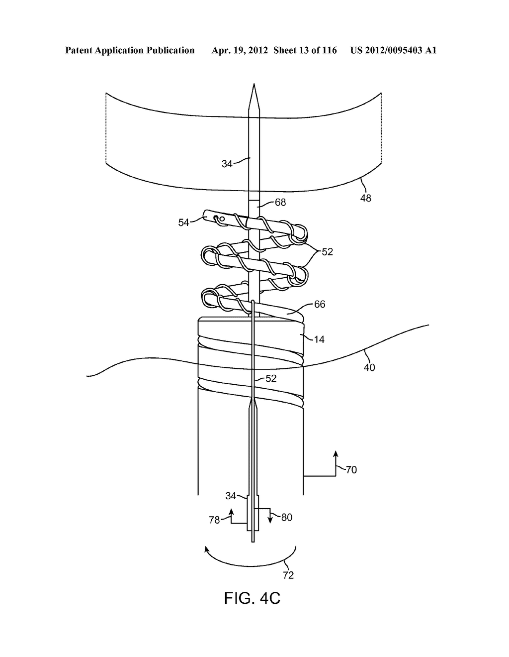 SYSTEM FOR PROVIDING SURGICAL ACCESS - diagram, schematic, and image 14