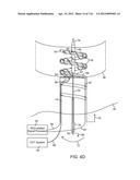 SYSTEM FOR PROVIDING SURGICAL ACCESS diagram and image