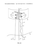 SYSTEM FOR PROVIDING SURGICAL ACCESS diagram and image