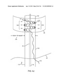 SYSTEM FOR PROVIDING SURGICAL ACCESS diagram and image