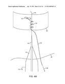 SYSTEM FOR PROVIDING SURGICAL ACCESS diagram and image