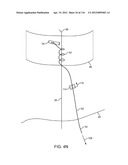 SYSTEM FOR PROVIDING SURGICAL ACCESS diagram and image