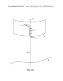 SYSTEM FOR PROVIDING SURGICAL ACCESS diagram and image