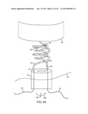 SYSTEM FOR PROVIDING SURGICAL ACCESS diagram and image