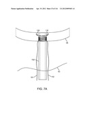 SYSTEM FOR PROVIDING SURGICAL ACCESS diagram and image