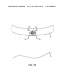 SYSTEM FOR PROVIDING SURGICAL ACCESS diagram and image