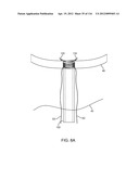 SYSTEM FOR PROVIDING SURGICAL ACCESS diagram and image