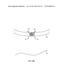 SYSTEM FOR PROVIDING SURGICAL ACCESS diagram and image