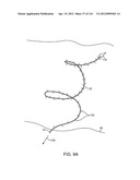 SYSTEM FOR PROVIDING SURGICAL ACCESS diagram and image