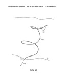 SYSTEM FOR PROVIDING SURGICAL ACCESS diagram and image