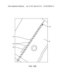 SYSTEM FOR PROVIDING SURGICAL ACCESS diagram and image