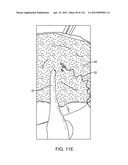 SYSTEM FOR PROVIDING SURGICAL ACCESS diagram and image