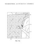 SYSTEM FOR PROVIDING SURGICAL ACCESS diagram and image