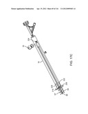 SYSTEM FOR PROVIDING SURGICAL ACCESS diagram and image