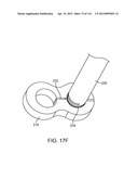 SYSTEM FOR PROVIDING SURGICAL ACCESS diagram and image