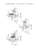 SYSTEM FOR PROVIDING SURGICAL ACCESS diagram and image