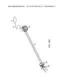 SYSTEM FOR PROVIDING SURGICAL ACCESS diagram and image