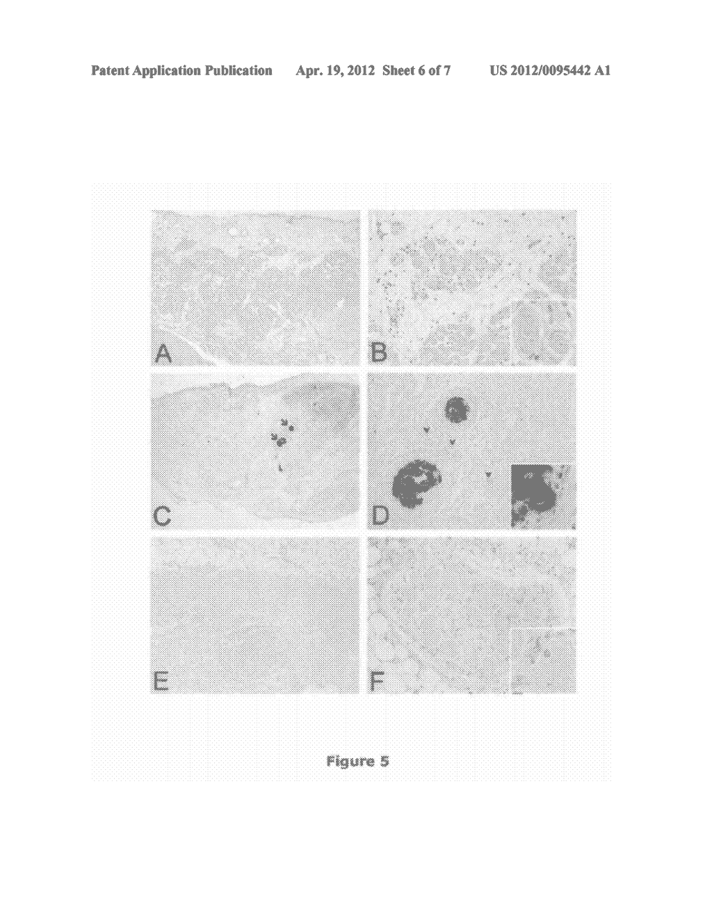 MAGNETICALLY-TARGETED TREATMENT FOR CARDIAC DISORDERS - diagram, schematic, and image 07