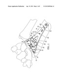 Orthopedic Plate Assembly for a Distal Radius Having Re-Contouring     Features and Method for Using Same diagram and image