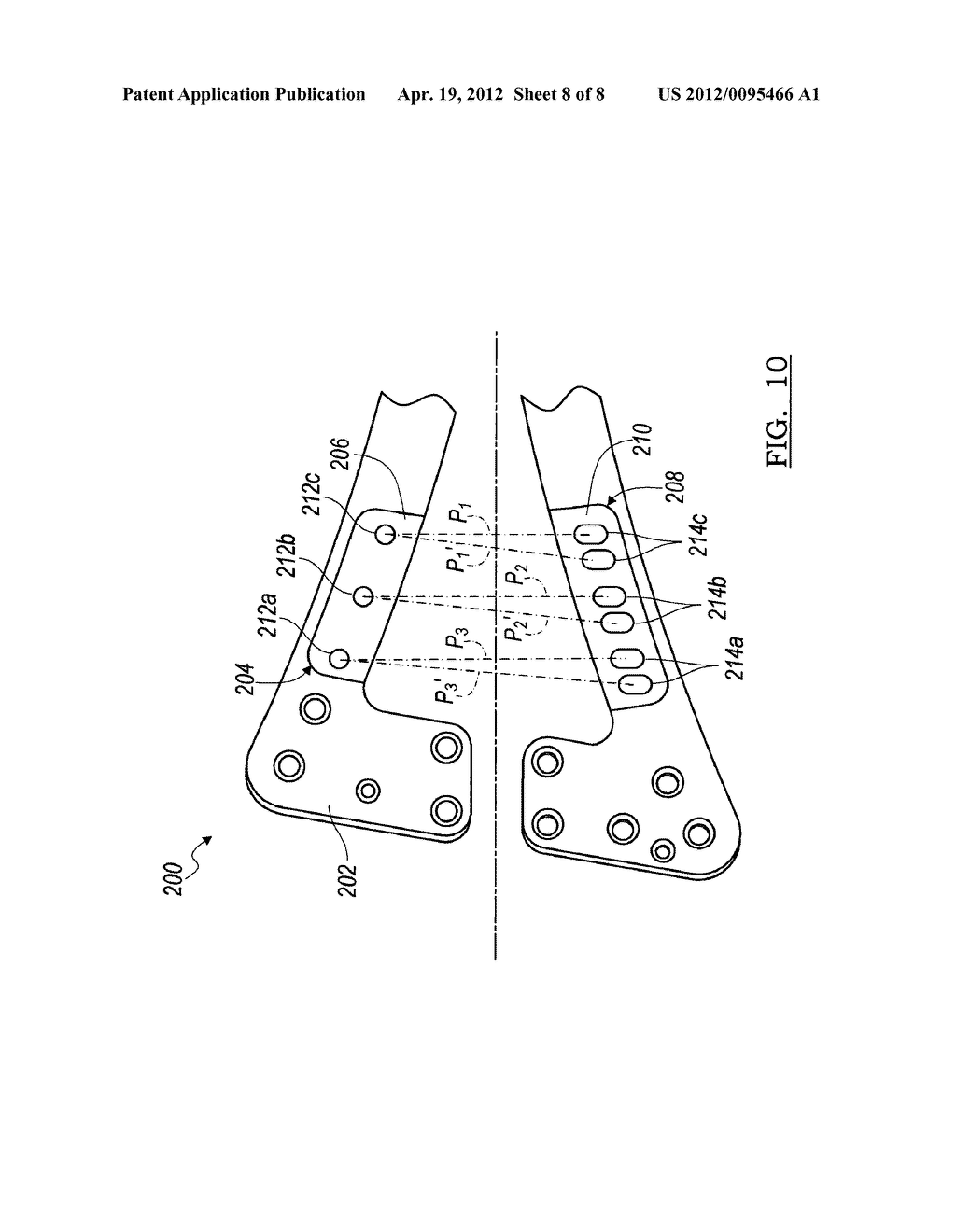 Orthopedic Plate Assembly for a Distal Radius Having Re-Contouring     Features and Method for Using Same - diagram, schematic, and image 09