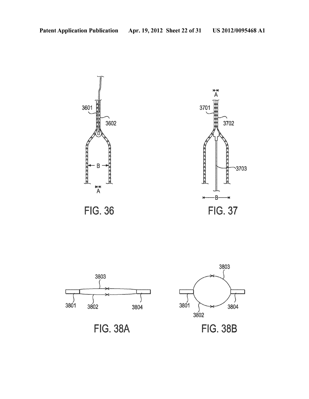 TISSUE MODIFICATION DEVICES AND METHODS - diagram, schematic, and image 23