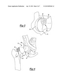 Method and Apparatus for Harvesting Cartilage for Treatment of a Cartilage     Defect diagram and image