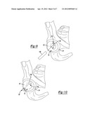 Method and Apparatus for Harvesting Cartilage for Treatment of a Cartilage     Defect diagram and image