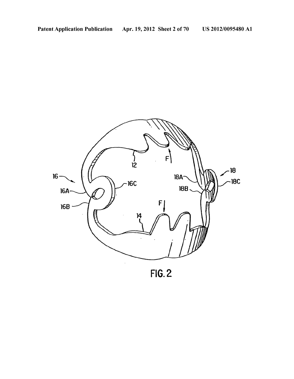 Apparatus and Method for Compressing Body Tissue - diagram, schematic, and image 03