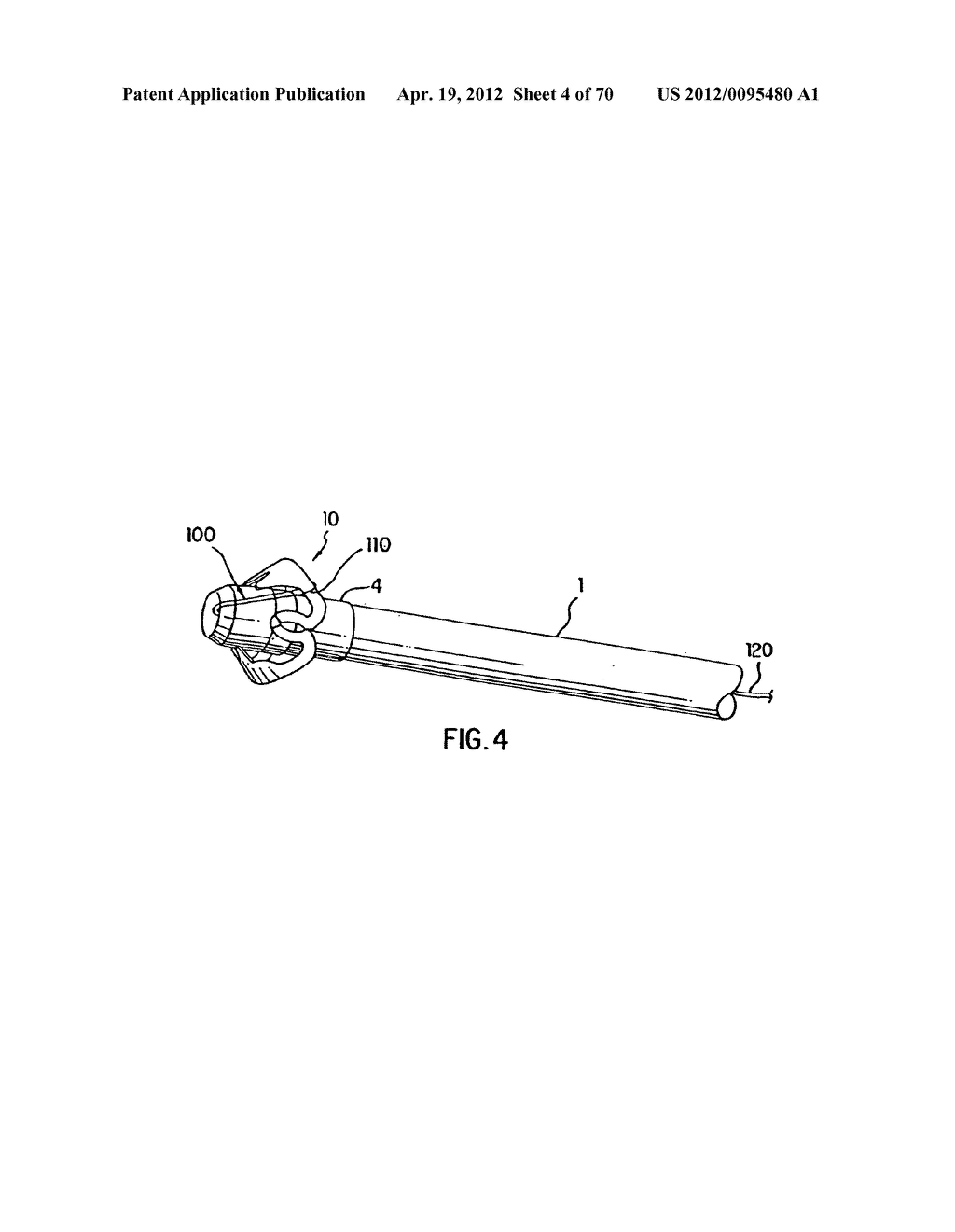 Apparatus and Method for Compressing Body Tissue - diagram, schematic, and image 05